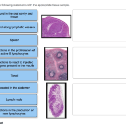 Appropriate tissue statements match following anatomy physiology functions react somple antigens spleen mouth present found answers questions node lymph cavity